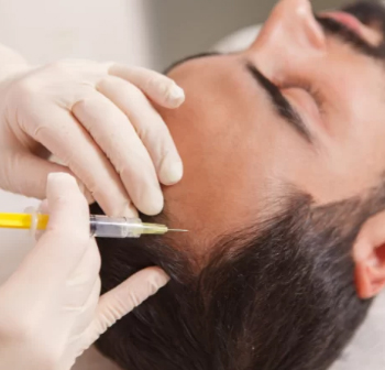 PRP Treatment